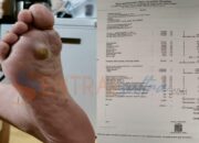 Biaya Operasi RSUD Bahteramas Kendari Mahal, Rakyat Menjerit