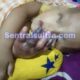 Tangan Balita Diduga Melepuh dan Bernanah Usai Diinfus, Keluarga Keluhkan Pelayanan RS Bhayangkara Kendari