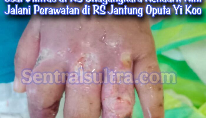 Tangan Balita Diduga Melepuh dan Bernanah Usai Diinfus di RS Bhayangkara Kendari, Kini Jalani Perawatan di RS Jantung Oputa Yi Koo